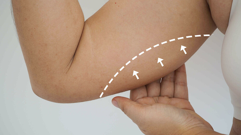 Behandlung bei Lipödem: Ernährung, Bewegung und Therapie im Fokus